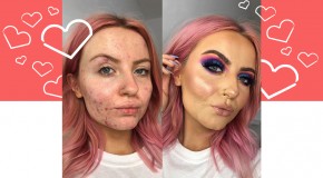 Abbie Bull's Acne Positivity Will Inspire You To Embrace Your Skin