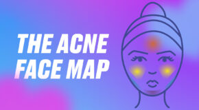 Face Mapping: What Do Your Spots Mean?